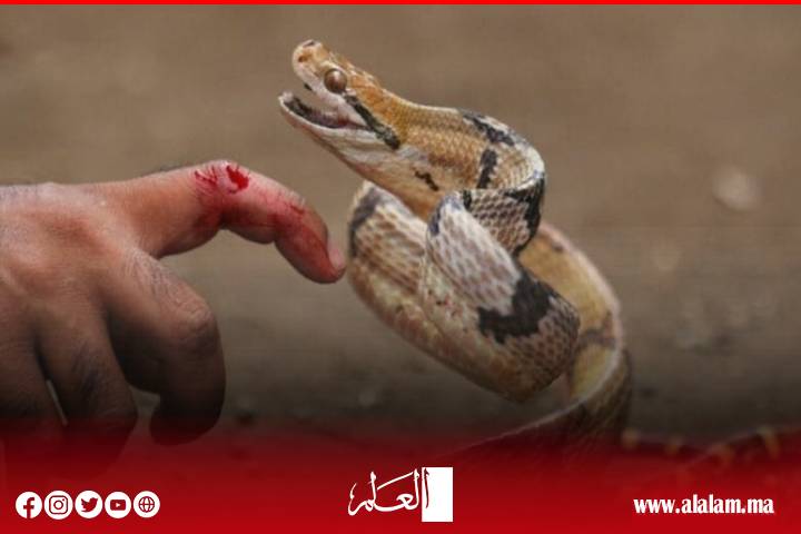 Une morsure de serpent envoie un jeune homme du rond-point Ashran au service de réanimation